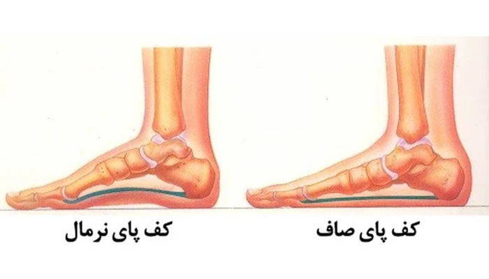 صافی کف پا